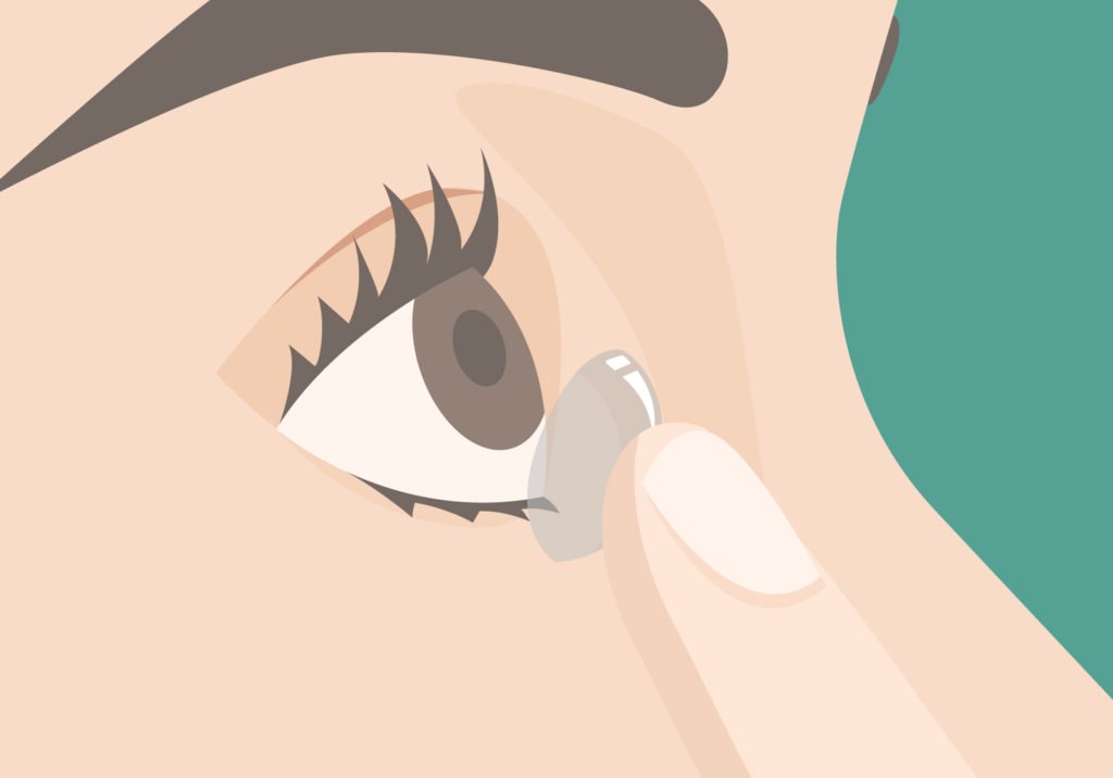 Mit Kontaktlinsen schlafen - es ist weit verbreitet, aber auch gefährlich